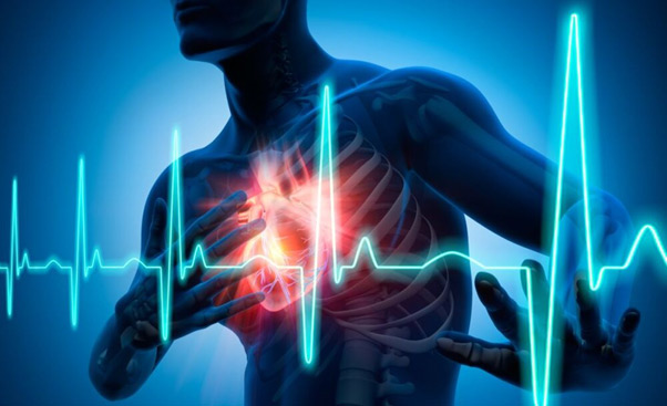 Cardiovascular Disease Management With Functional Medicine