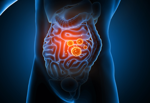 Gut Healing Therapies With Functional Medicine