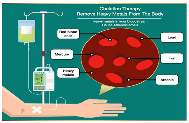 INTRAVENOUS CHELATION THERAPY INDIA